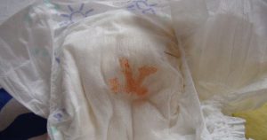 Como Es El Pis Normal De Los Bebes Y Que Debemos Vigilar Cuidados Y Caricias
